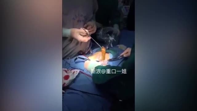 Bác sĩ gắp con lươn ra khỏi cơ thể nam thanh niên