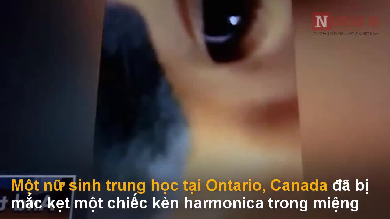 Cô bé kẹt kèn harmonica trong miệng vì quay clip câu views trên TikTok